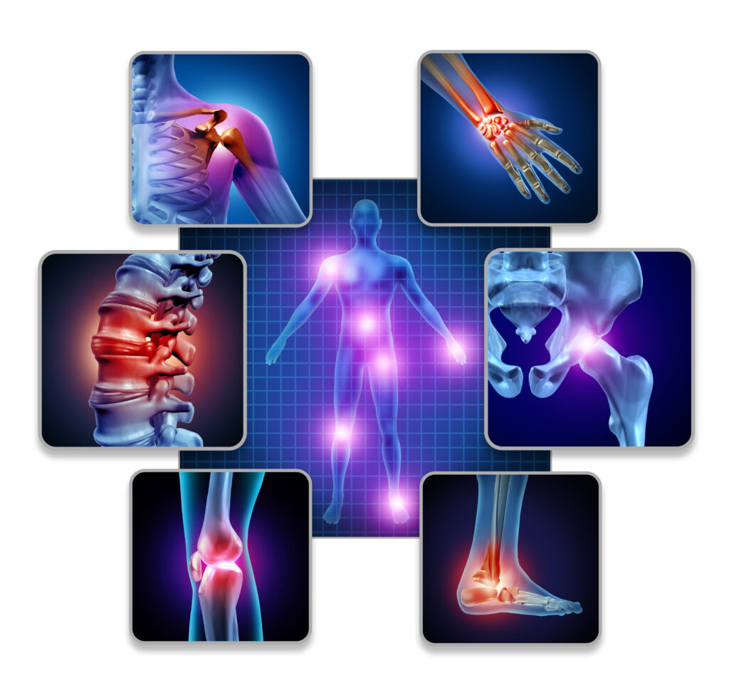 Health graphic depicting areas of joint pain due to inflammation