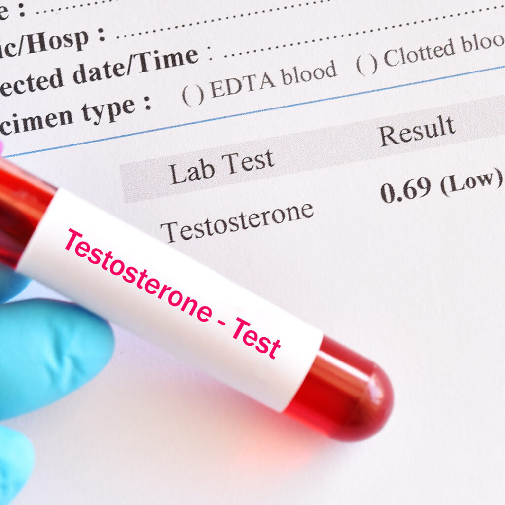 Image showing a test tube for a testosterone blood test with a low testosterone hormone result sheet